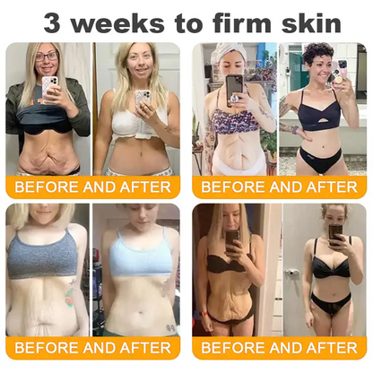 ✨FDA Approved: Bee Venom Skin Restoration Cream — 🔥Limited Time 70% OFF🔥