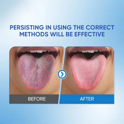 DarkFairy Probiotics Mint Tongue Cleaning Kit  1 Min Deep Clean for Stubborn Coating Bad Breath Post Meal Smoking Essential 50g Long Lasting Freshness