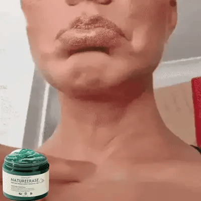 🔥✨LOVILDS™ NatureErase Instant Mole & Spot Removal Gel ✨