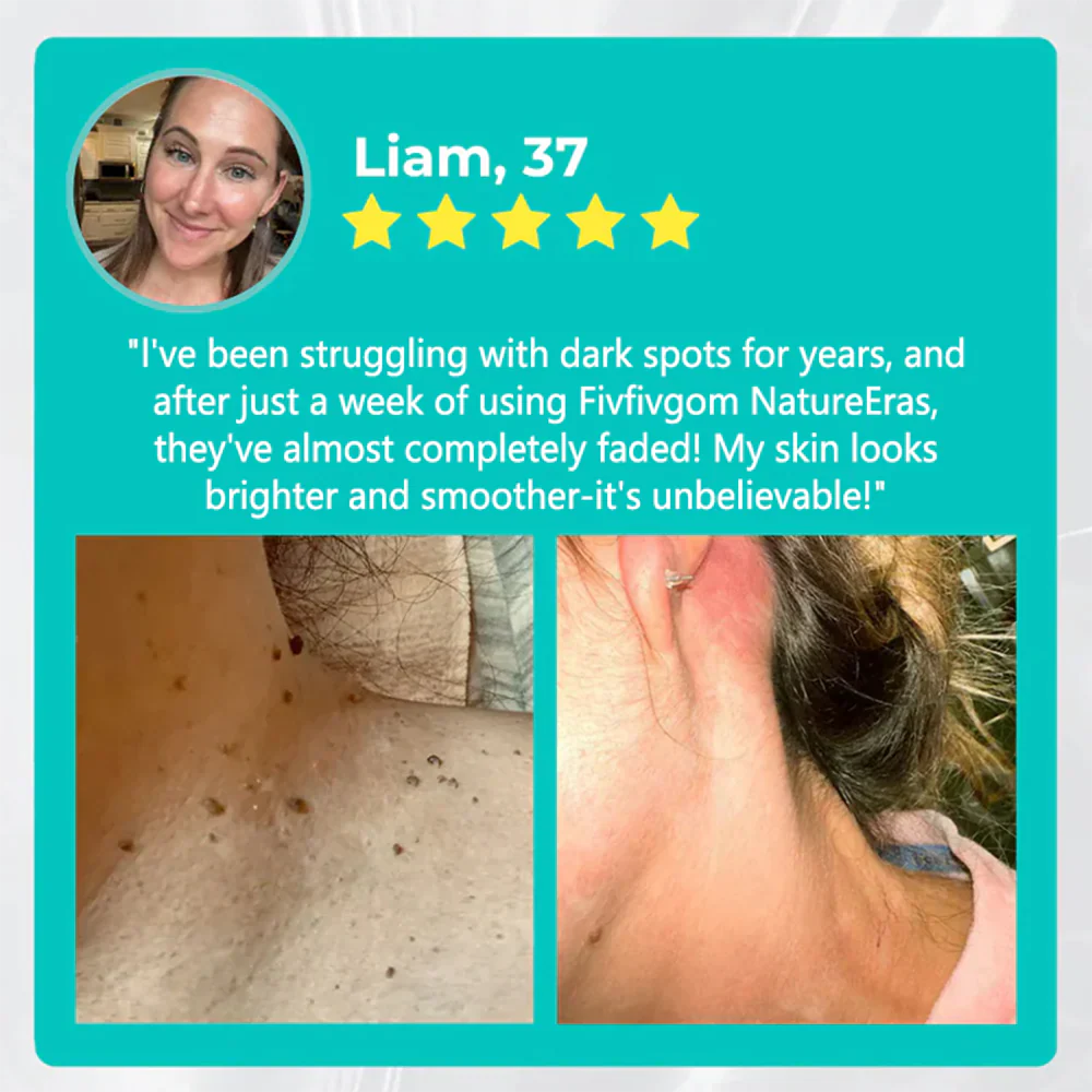 🔥✨LOVILDS™ NatureErase Instant Mole & Spot Removal Gel ✨