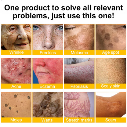 ✨FDA Approved: Bee Venom Skin Restoration Cream — 🔥Limited Time 70% OFF🔥