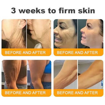 ✨FDA Approved: Bee Venom Skin Restoration Cream — 🔥Limited Time 70% OFF🔥